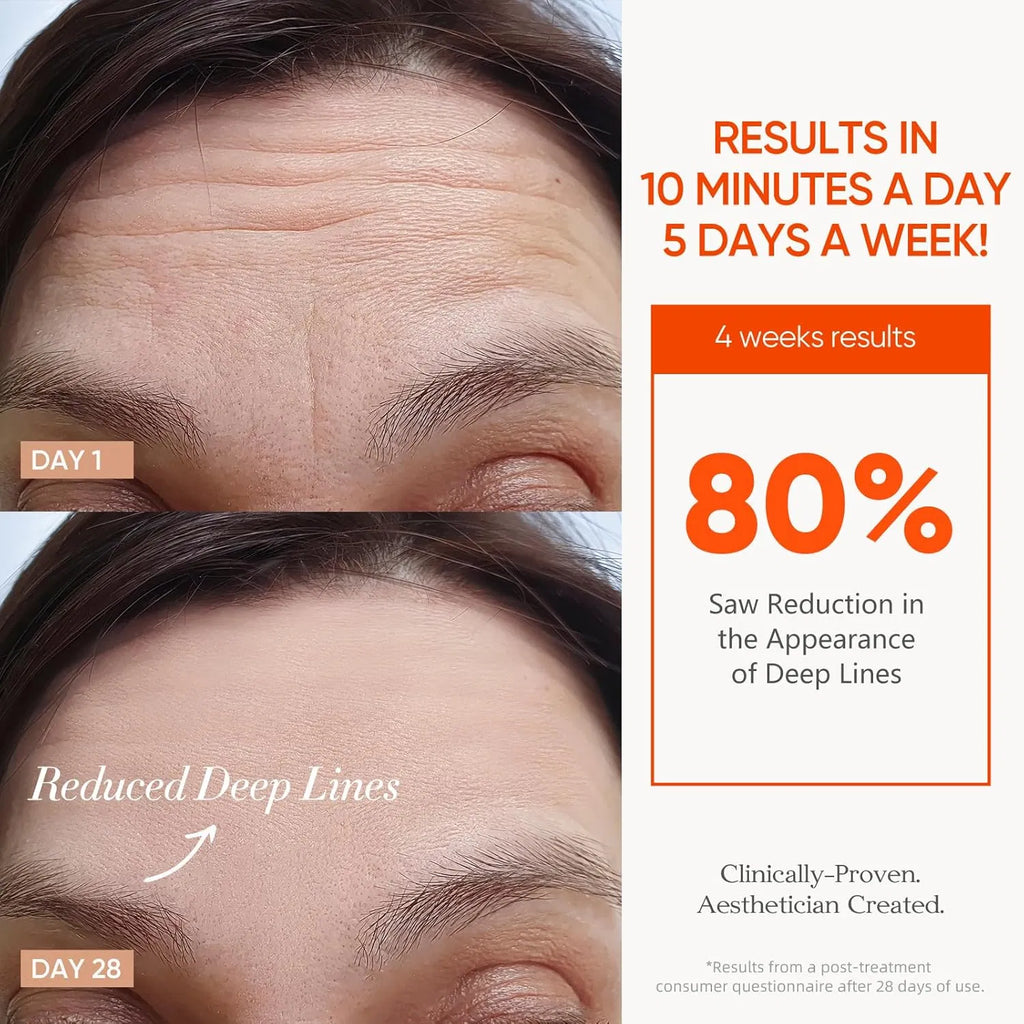 Cordless LED therapy mask For Wrinkle & Acne Reducing