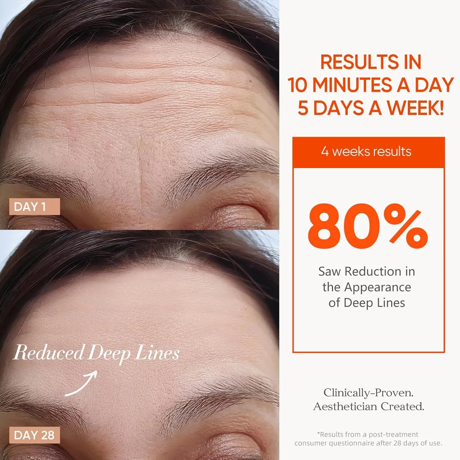 Cordless LED therapy mask For Wrinkle & Acne Reducing