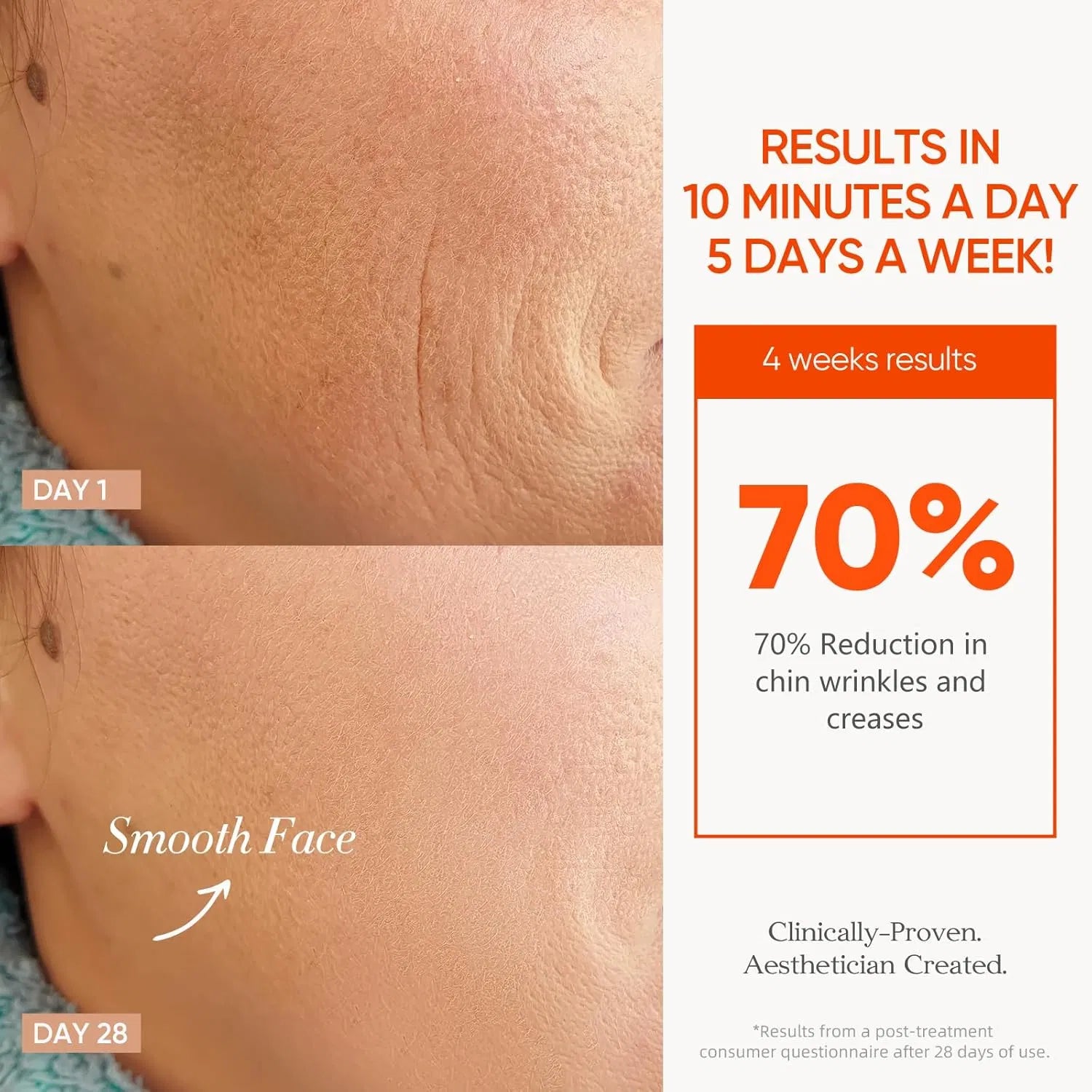 Cordless LED therapy mask For Wrinkle & Acne Reducing