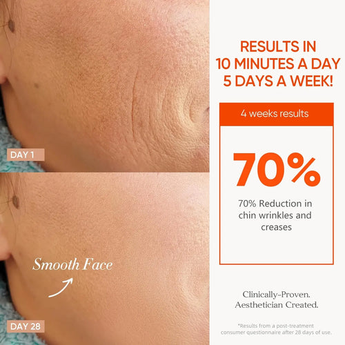 Cordless LED therapy mask For Wrinkle & Acne Reducing